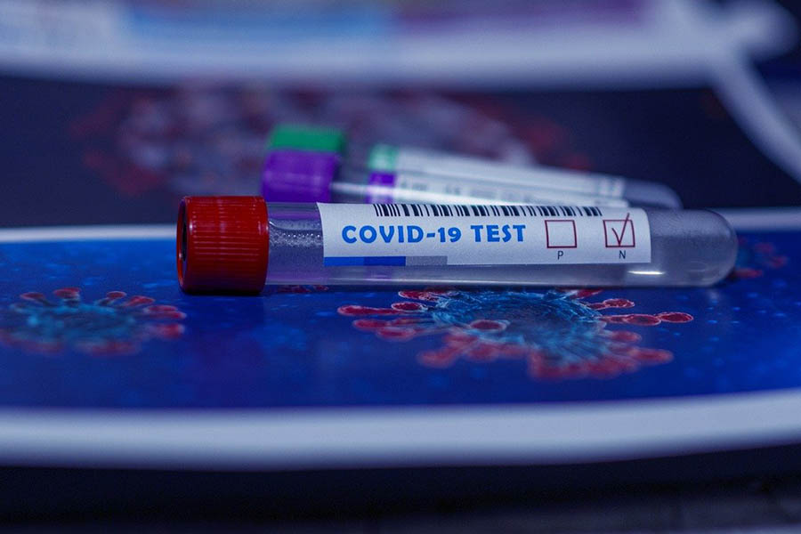 В Брянской области выявили три случая нового штамма коронавируса «омикрон»